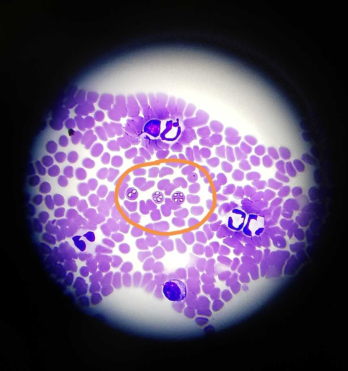 Babesia koiralla